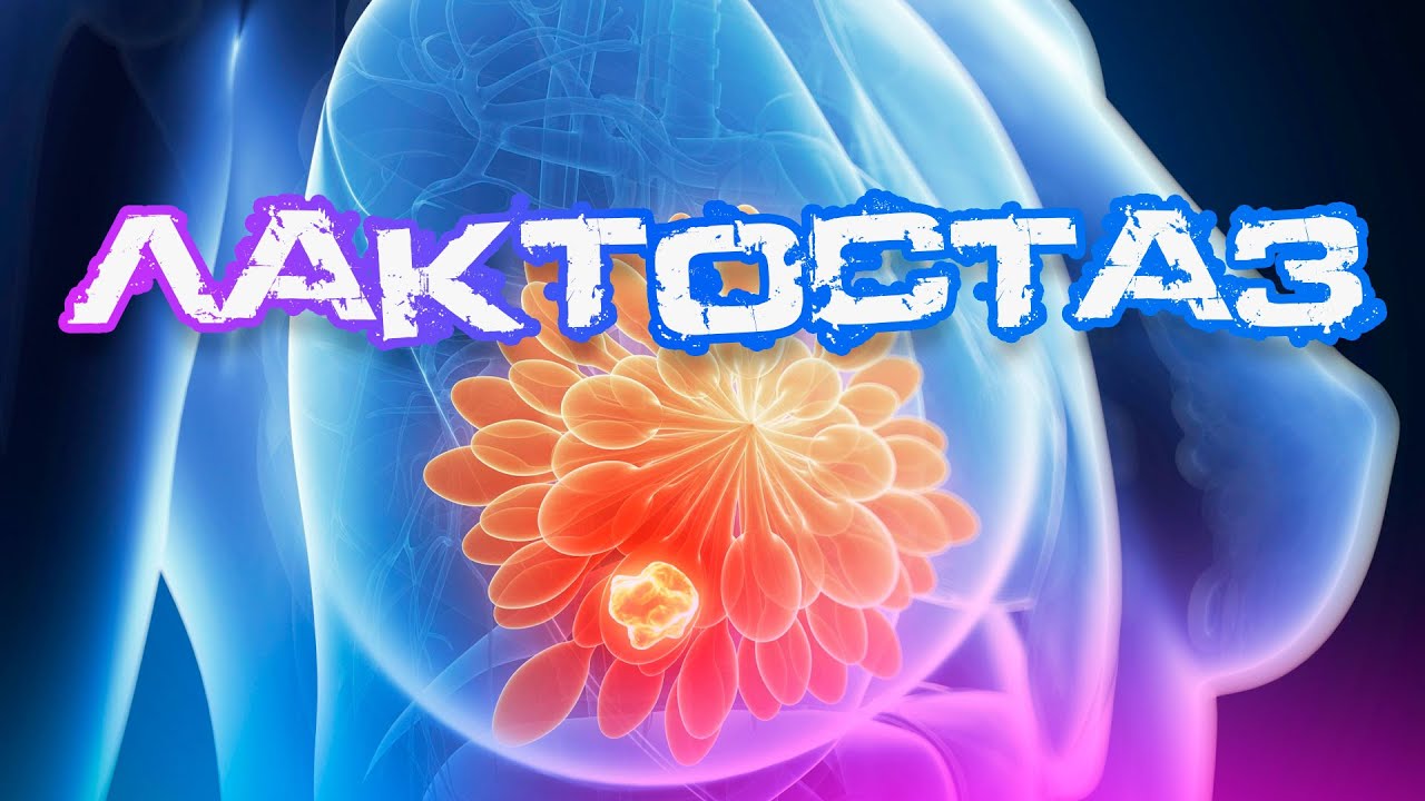 Лактостаз: причины, лечение и профилактика от врача-невролога ...