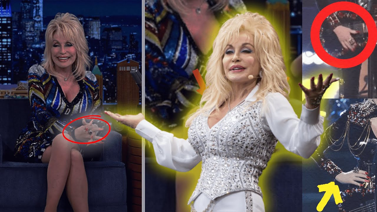 The Real Reason Dolly Parton Wears Fingerless Gloves! - YouTube