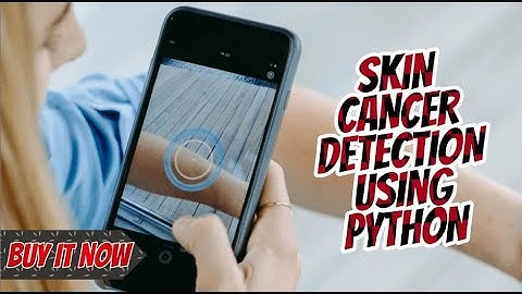 Skin Cancer Detection Using Python | Skin Cancer Detection Using CNN | Final Year Python Projects