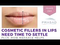 Lip Augmentation - How Fillers Need Time to Settle, and How Massage Helps