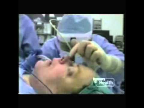 Dr. Randal Haworth - Discovery Health - Plastic Surgery Before and After