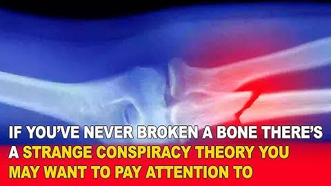 If You’ve Never Broken a Bone, This Strange Conspiracy Theory Will Blow Your Mind! 🦴🤯