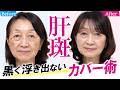 【肝斑・シミの落とし穴】ただ塗るだけじゃ消えない?Zoom画面で黒く浮き出ないカバー術