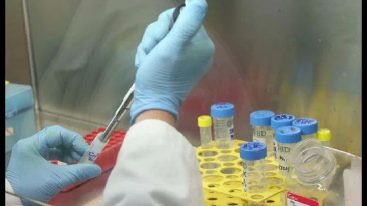 New hope for patients as genetic mutation causing psoriasis is identified