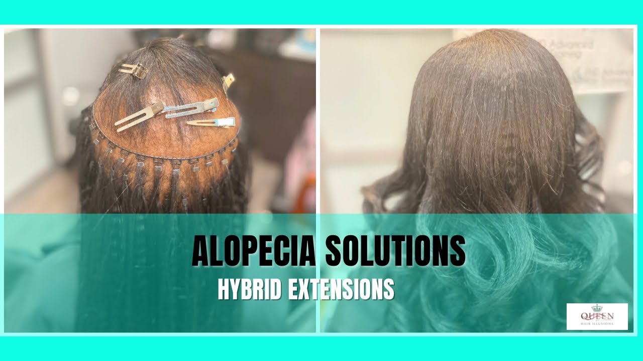 Alopecia Hairstyles & Solutions: Seamless I-Tips and Braidless Sew-In Transformation
