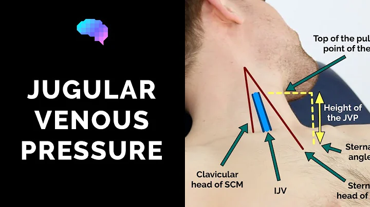 Measuring Jugular Venous Pressure (JVP) - OSCE Guide (Clip) | UKMLA | CPSA | PLAB 2