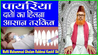 हिलते हुए दांतों का इलाज ll Dental disease ll Danton ka Hilna Kaise Band Karen ll पायरिया