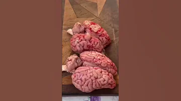 Brain Fell Out Brainout Family Familyfun 