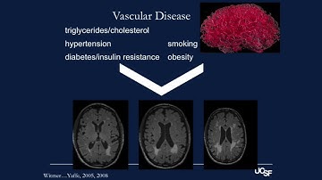 “Healthy Brain Aging” by Kaitlin Casaletto, PhD, at MAC Research Education Event