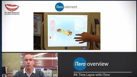 Dr. Rafi Romano, iTero Overview- part 8: Time Lapse