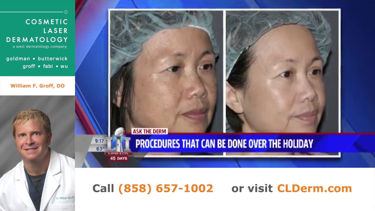 Banner for Ask the Derm: Common Dermatology Treatments During the Holiday Season