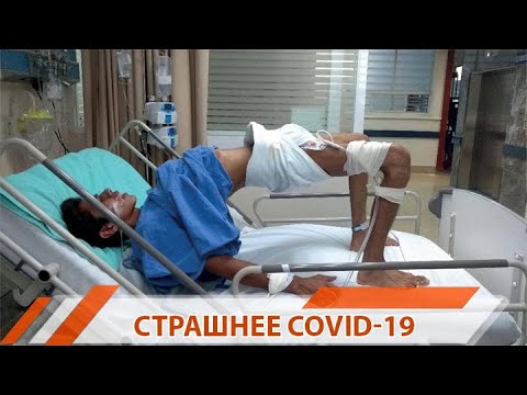 Страшнее чем Covid-19: первый за 17 лет случай столбняка зарегистрирован на Урале | #4канал