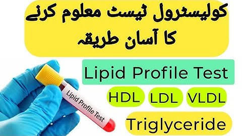 How To Read Cholesterol Test Report Urdu Hindi | Lipid Profile Test | HDL - LDL -Triglycerides Test
