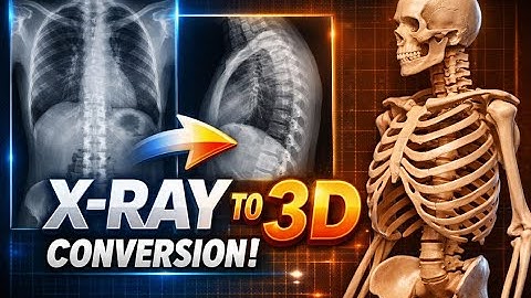X Ray To 3d Conversion