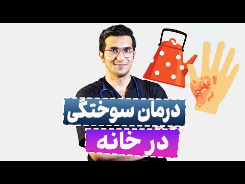 درمان سوختگی | Burns: Classification and Treatment