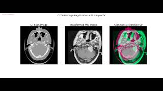 Medical Image Processing | Image Segmentation | Registration |  Morphological operations | python