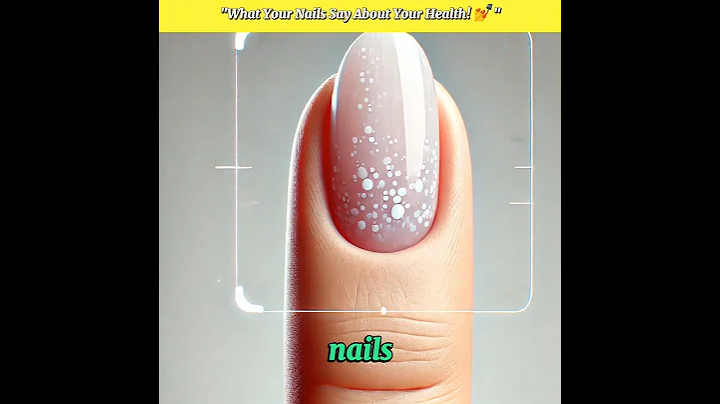 😱 What Your Nails Say About Your Health! 💅 #shorts