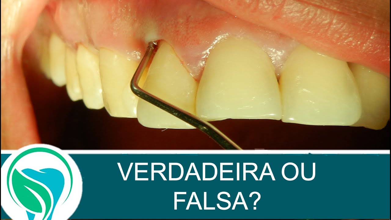 Compreenda os diferentes tipos de bolsas periodontais