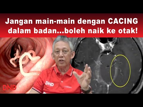 Video: Adakah cacing kelabu mati?