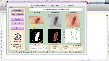 Skin Disease Detection Using Image Processing Matlab Project Code