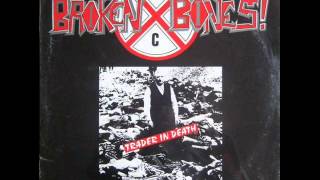 Broken Bones - Crack Attack