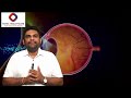 Consult best eye doctors  konic healthcare  sarvesh dhir