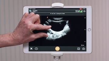 Clarius Feature: Zoom