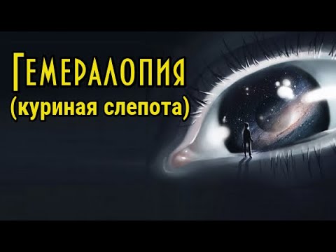 Гемералопия. Куриная слепота лечение