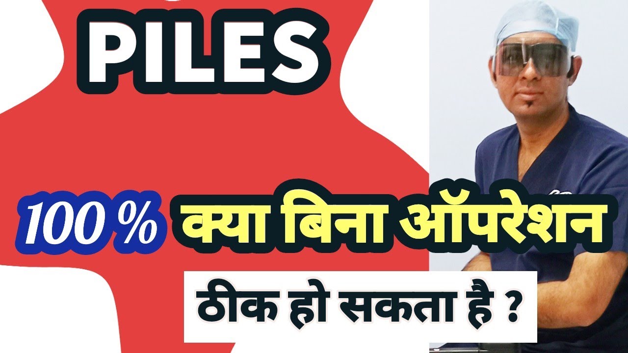 PILES क्या बिना ऑपरेशन 100 ठीक हो सकता हैं BAWASIR HEMORRHOIDS treatment. Permanent Cure