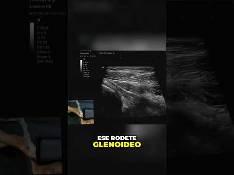 Descubre cómo se