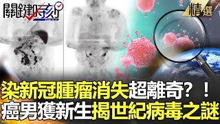 精選│染新冠腫瘤離奇消失？！ 癌男起死回生揭世紀病毒之謎 【關鍵時刻】-劉寶傑 李正皓  陳東豪 陳耀寬 李奇嶽 姚惠珍