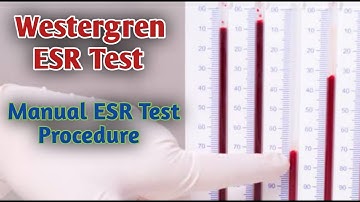 westergren test procedure I Westegrens ESR test procedure
