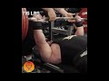  warning painful gym accident  rare pectoralischest muscle tear  muscles tear aftermath shorts