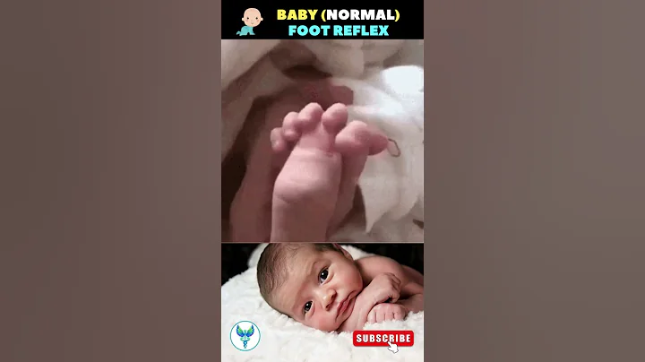 Normal Baby Reflex 🦶Foot reflex | Plantar Reflex ✅  Infant reflexes #baby #health #shortsfeed - 天天要聞