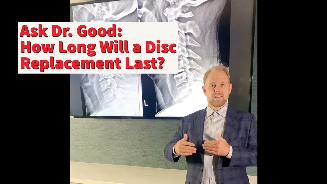 Ask the Expert How Long Does a Disc Replacement Last? YouTube