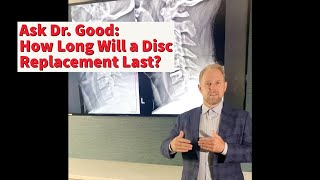 Ask the Expert: How Long Does a Disc Replacement Last?