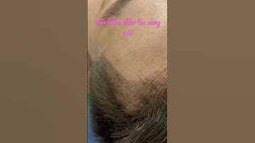 Điêu khắc chân tóc vùng mái, sợi tóc siêu nét