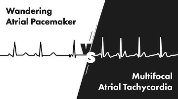 Wandering Atrial Pacemaker vs Multifocal Atrial Tachycardia - ECG (EKG) Interpretation - MEDZCOOL