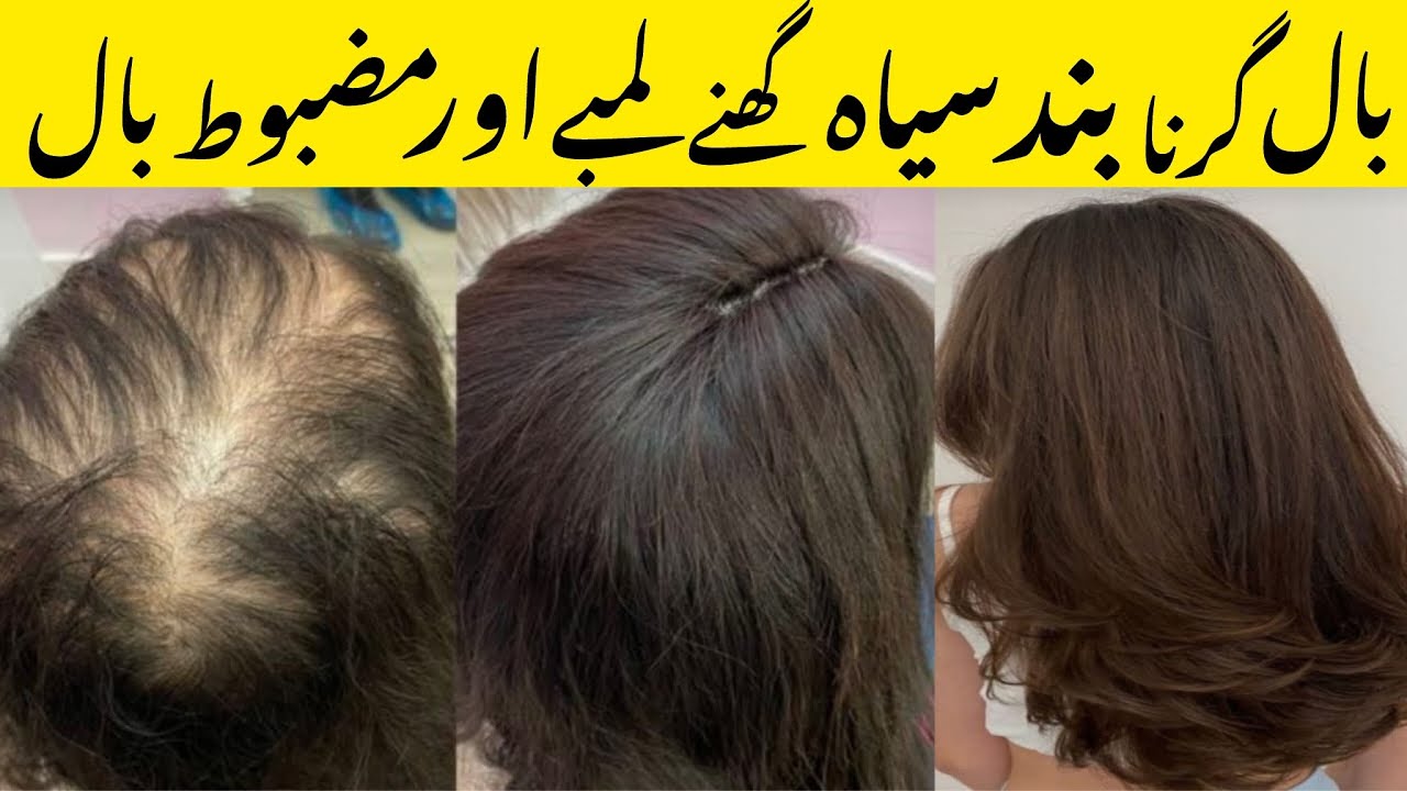 Hair Falling Treatment At Home Stop Hair Falling Long & Strong hair