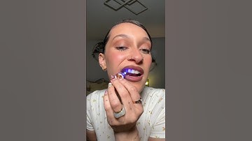 GIVING MYSELF TOOTH GEMS!! #vlog