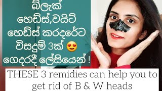 Remove black heads & white heads easily at home | 3 DIY Packs | get rid of pores on nose