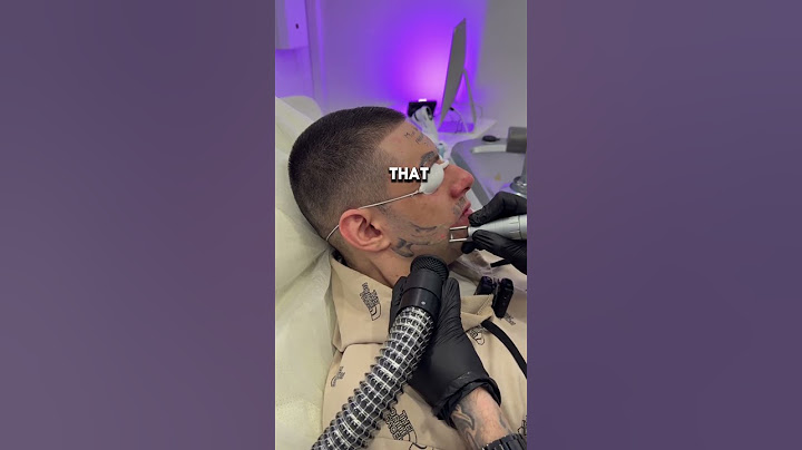 He Regretted This Face Tattoo (@sokolov.laser)