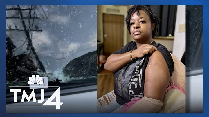 Road rage shooting victim warns Milwaukee drivers after being shot for honking horn