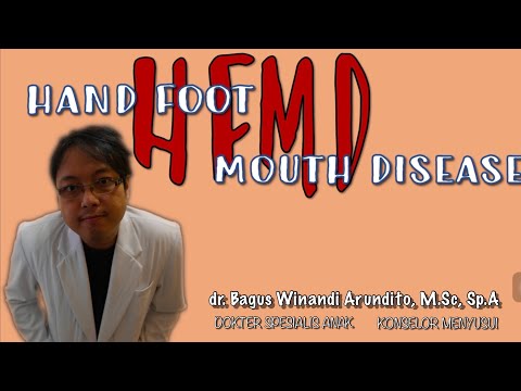 Bintik merah di tangan dan kaki +sariawan, jangan-jangan Hand Foot Mouth Disease