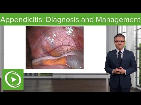 Appendicitis: Diagnosis and Management – General Surgery | Lecturio