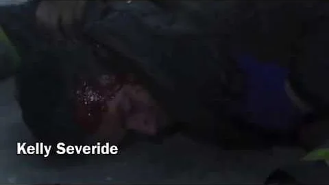 Chicago fire// Kelly severide