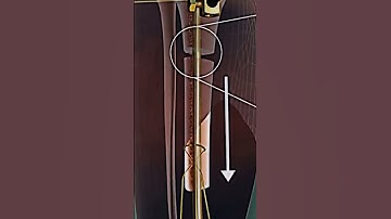 Leg Rod Placement 3D animated #medicoabdullah #shortsyoutube