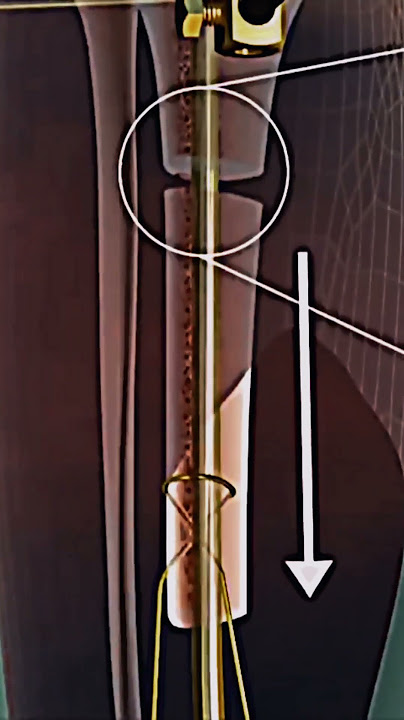 Leg Rod Placement 3D animated #medicoabdullah #shortsyoutube