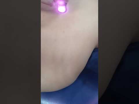  LASER de alta intensidad y reflexión