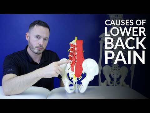 Video: Lower Back Pain: Causes, Prevention And Treatment
